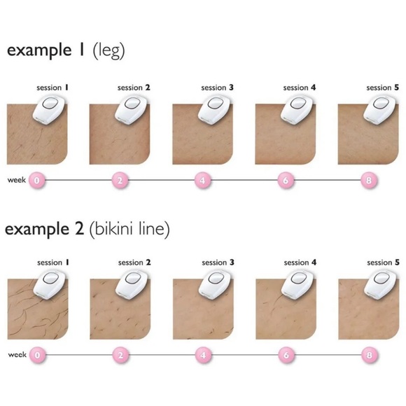 IPL Laser Hair Removal Epilator Device Permanent Body Machine Face Leg - Picture 8 of 13